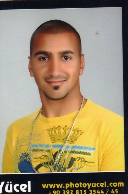 AKIN TOPAL